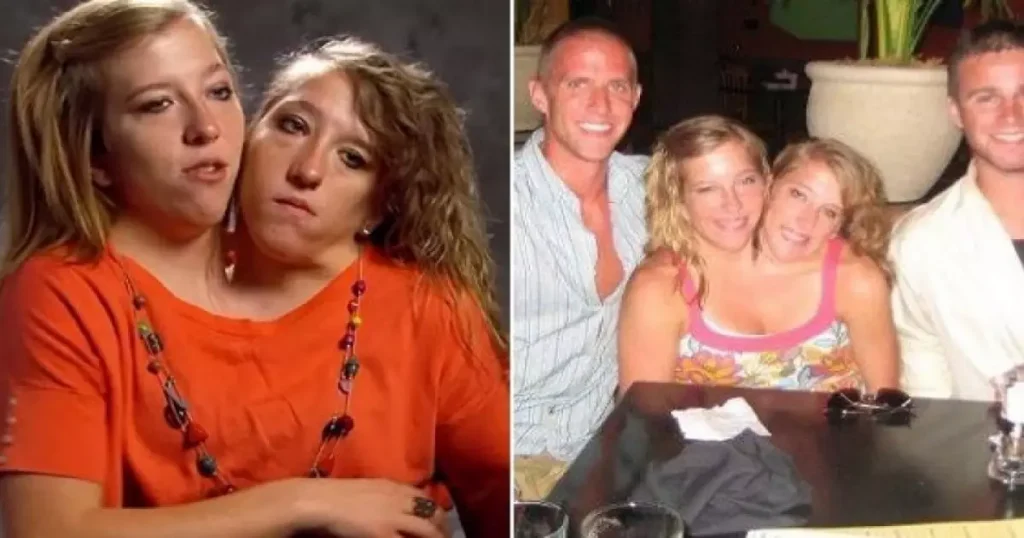 Abby Et Brittany Hensel Enceinte